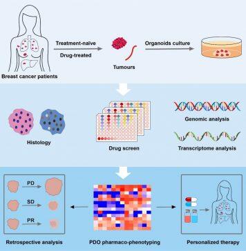 UM makes breakthrough in precision medicine treatment for breast cancer