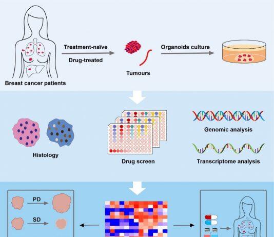 UM makes breakthrough in precision medicine treatment for breast cancer