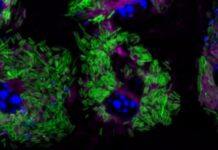 Researchers discover way to disarm potentially deadly Listeria bacteria