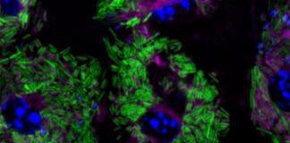 Researchers discover way to disarm potentially deadly Listeria bacteria