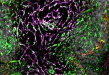 Spleen function discovery could lead to better treatments for infectious diseases