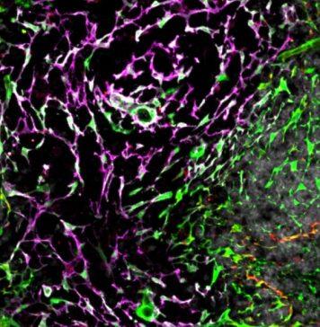 Spleen function discovery could lead to better treatments for infectious diseases