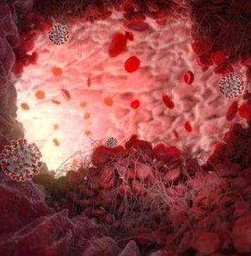 Gut health compromised in severe COVID-19