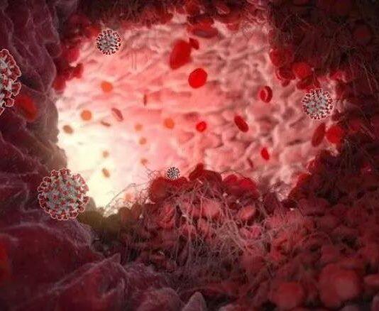Gut health compromised in severe COVID-19