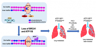 UM study helps suppress breast cancer metastasis