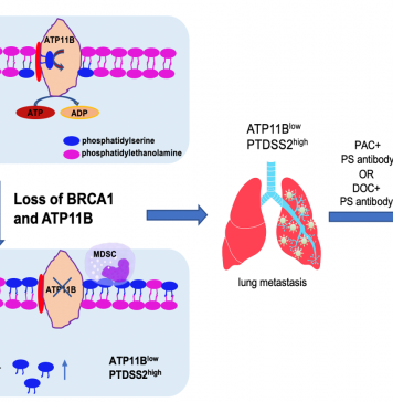 UM study helps suppress breast cancer metastasis
