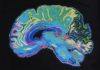 New study to look at what is happening in your brain under the influence of psychedelic drugs