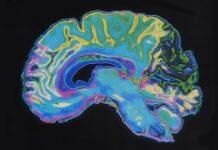 New study to look at what is happening in your brain under the influence of psychedelic drugs