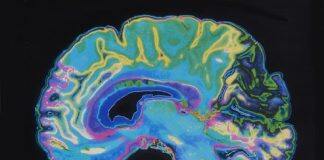 New study to look at what is happening in your brain under the influence of psychedelic drugs