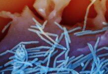 How COVID-19 created dramatic changes in a ‘winter virus’