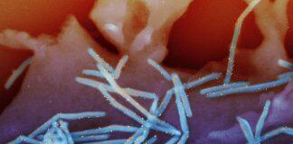 How COVID-19 created dramatic changes in a ‘winter virus’