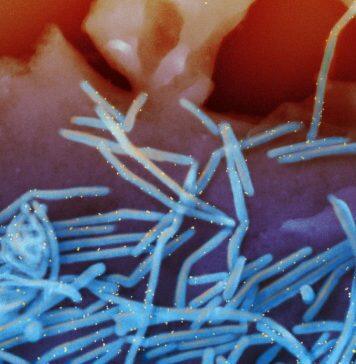 How COVID-19 created dramatic changes in a ‘winter virus’