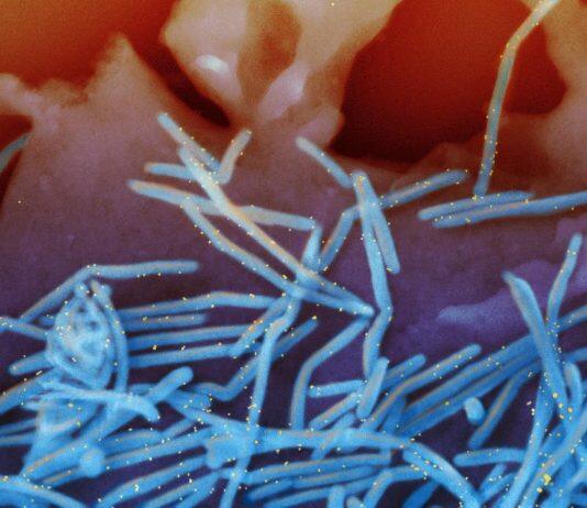 How COVID-19 created dramatic changes in a ‘winter virus’