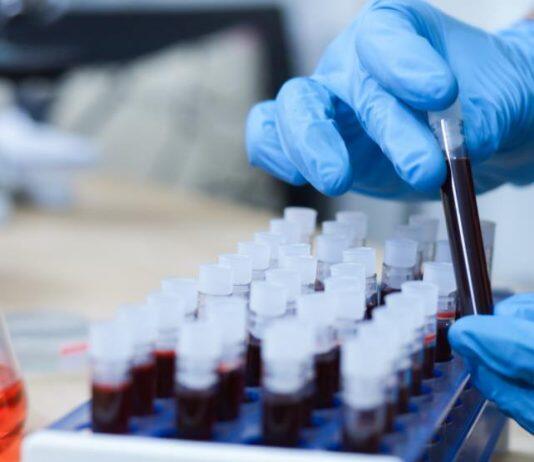 Researchers are engineering a new drug against blood cancers