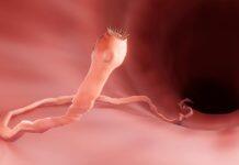 Parasites may take a heavier toll on mammal populations than previously thought