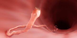 Parasites may take a heavier toll on mammal populations than previously thought