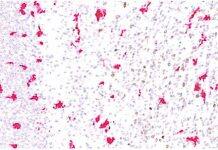 New study shows microglia cells colonise the human brain in waves