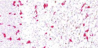 New study shows microglia cells colonise the human brain in waves