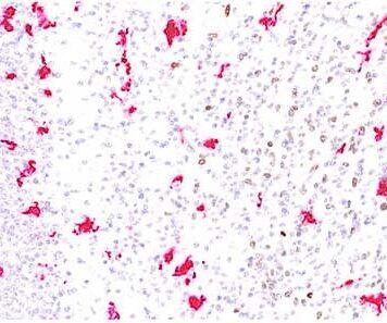 New study shows microglia cells colonise the human brain in waves