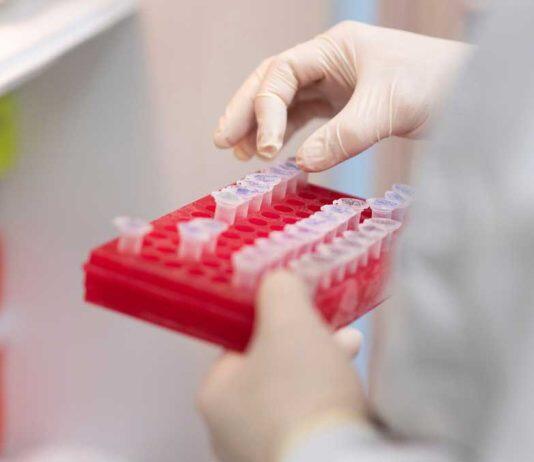 Federal funds set to boost University of Alberta’s ability to handle highly infectious pathogens