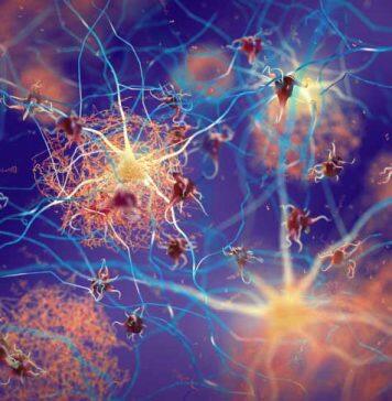 New research provides hope for drug treatment to slow neurodegenerative disease