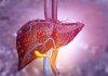Research shows fatty liver disease endangers brain health