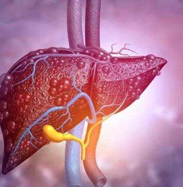Research shows fatty liver disease endangers brain health