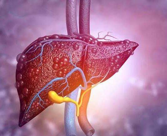 Research shows fatty liver disease endangers brain health