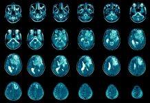 University of Glasgow cancer experts to receive £1.7m from Cancer Research UK