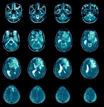 University of Glasgow cancer experts to receive £1.7m from Cancer Research UK
