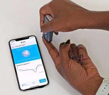 Life-saving light beam to detect malaria