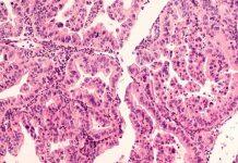 £2.2m For Glasgow Cancer Centre To Help Find New Treatments