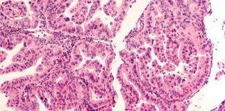 £2.2m For Glasgow Cancer Centre To Help Find New Treatments