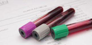 Blood cancer manipulates immune cells to survive