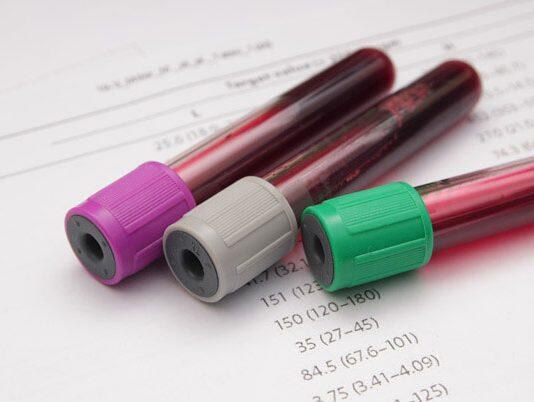 Blood cancer manipulates immune cells to survive