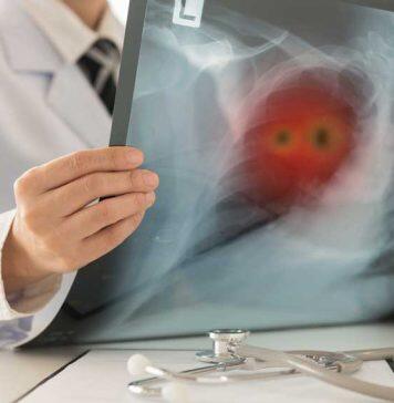 Lung cancer and mesothelioma research receives funding boost