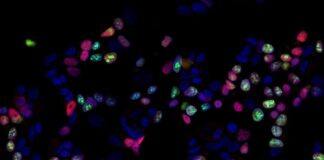 Androgen study could lead to new treatments for breast cancer