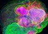 Using tiny brains to treat rare, hereditary diseases