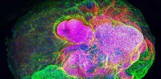 Using tiny brains to treat rare, hereditary diseases