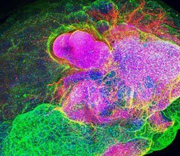 Using tiny brains to treat rare, hereditary diseases