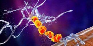 Motor neuron disease treatments a step closer