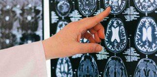 Traumatic brain injuries under the microscope