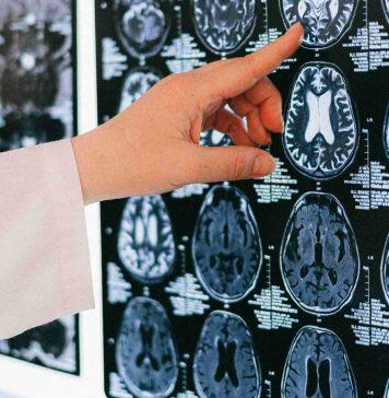 Traumatic brain injuries under the microscope
