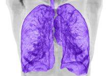 New MRI scanning technology to improve clinical accessibility and advance lung disease diagnosis