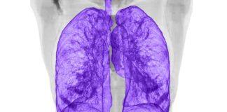New MRI scanning technology to improve clinical accessibility and advance lung disease diagnosis