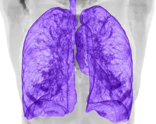 New MRI scanning technology to improve clinical accessibility and advance lung disease diagnosis