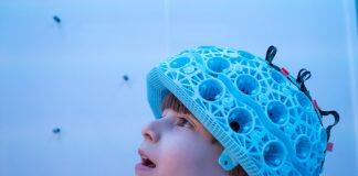 Brain imaging is on the move with wearable scanning development