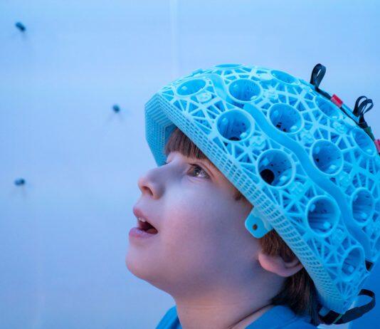 Brain imaging is on the move with wearable scanning development