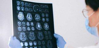 Cannabinoid-based drug trial for brain tumours begins