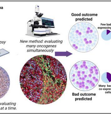 NUS researchers develop novel approach for predicting resistance against cancer therapy